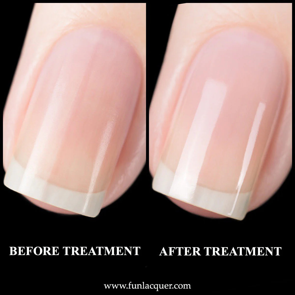 Premium Nail Treatment